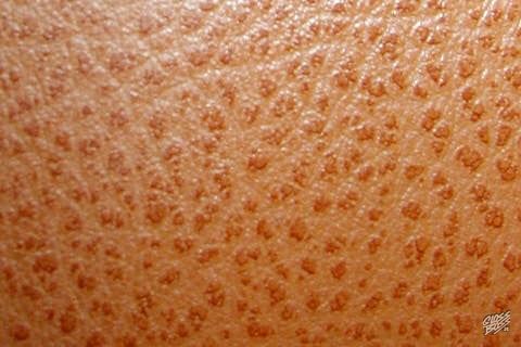 MERCEDES-BENZ - NATUR ANTIK